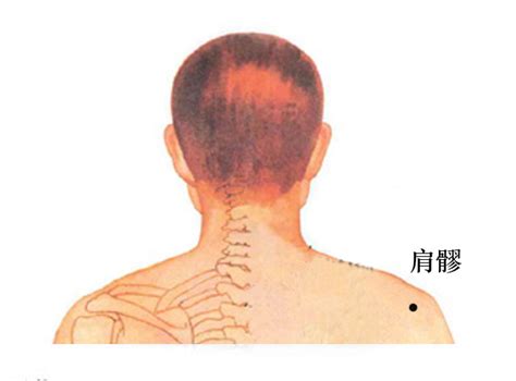 肩ㄩˊ穴|肩髎:命名,穴位解剖,穴位找法,標準定位,取法,操作方法,刺法,灸法,。